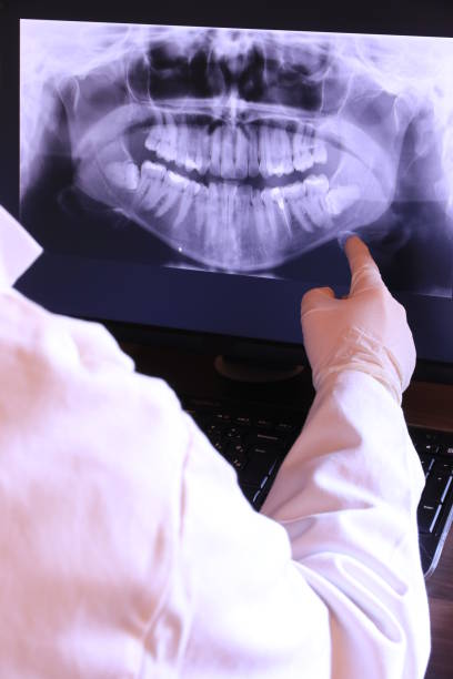 Best Urgent Care for Lost Fillings or Crowns in Springville, NY