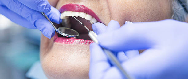 Best Emergency Tooth Extraction in Springville, NY